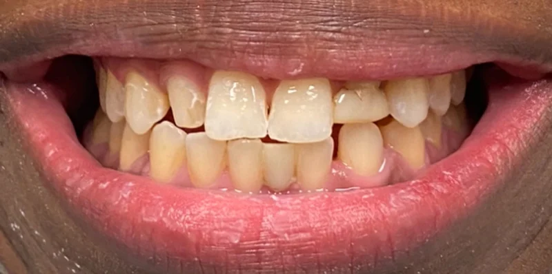 Before dental treatment